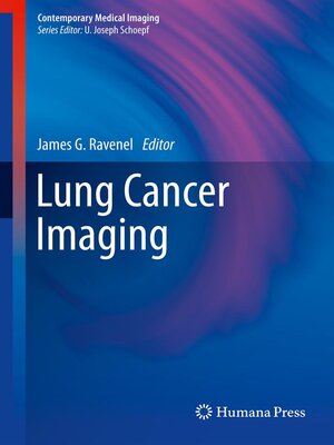 cover image of Lung Cancer Imaging